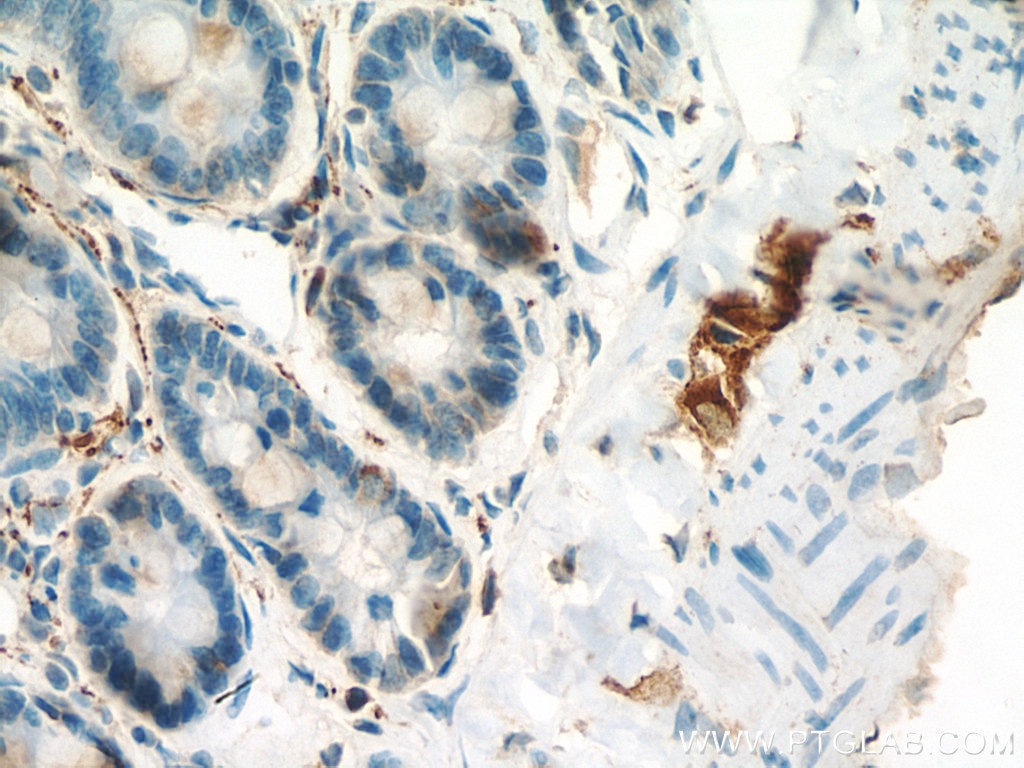 Immunohistochemistry (IHC) staining of rat small intestine tissue using VIP Polyclonal antibody (16233-1-AP)
