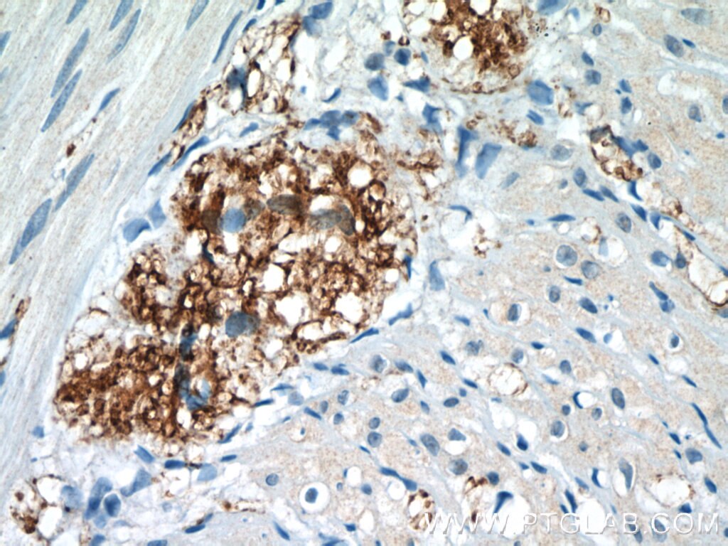 Immunohistochemistry (IHC) staining of human small intestine tissue using VIP Polyclonal antibody (16233-1-AP)