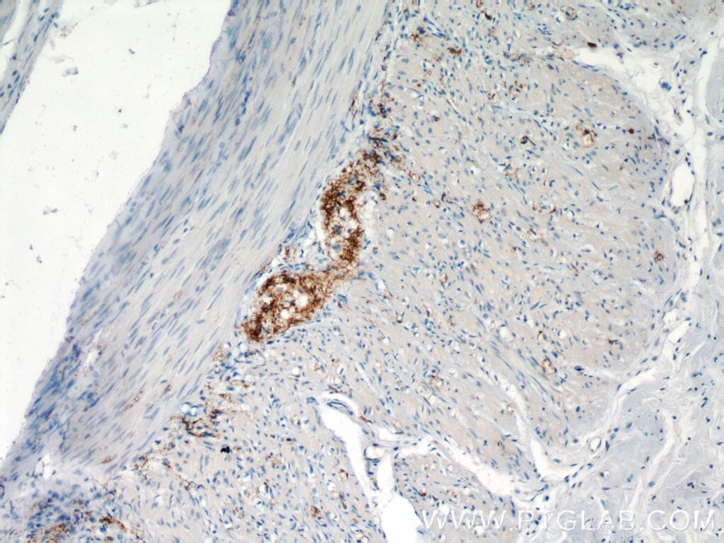 Immunohistochemistry (IHC) staining of human small intestine tissue using VIP Polyclonal antibody (16233-1-AP)