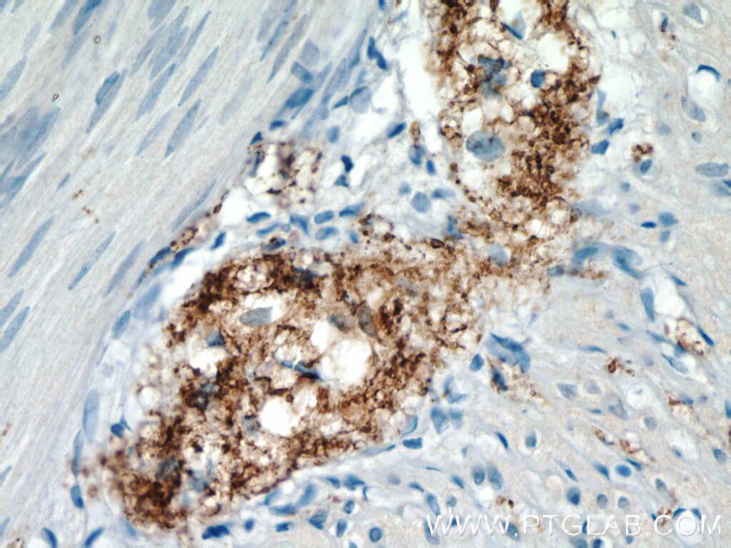 Immunohistochemistry (IHC) staining of human small intestine tissue using VIP Polyclonal antibody (16233-1-AP)