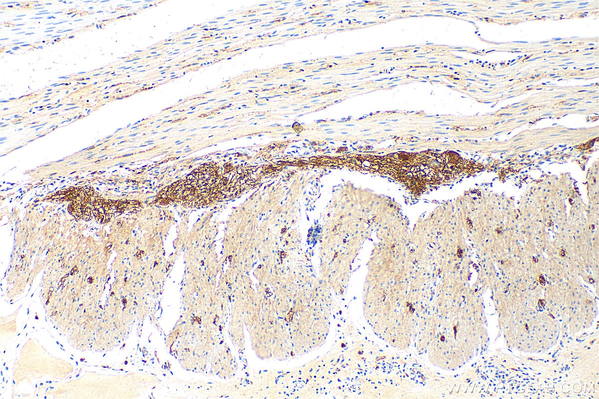 Immunohistochemistry (IHC) staining of human colon tissue using VIP Polyclonal antibody (16233-1-AP)