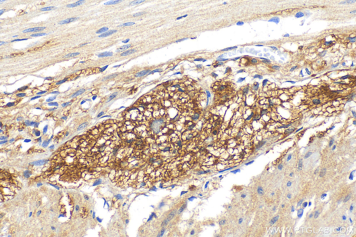 IHC staining of human colon using 16233-1-AP