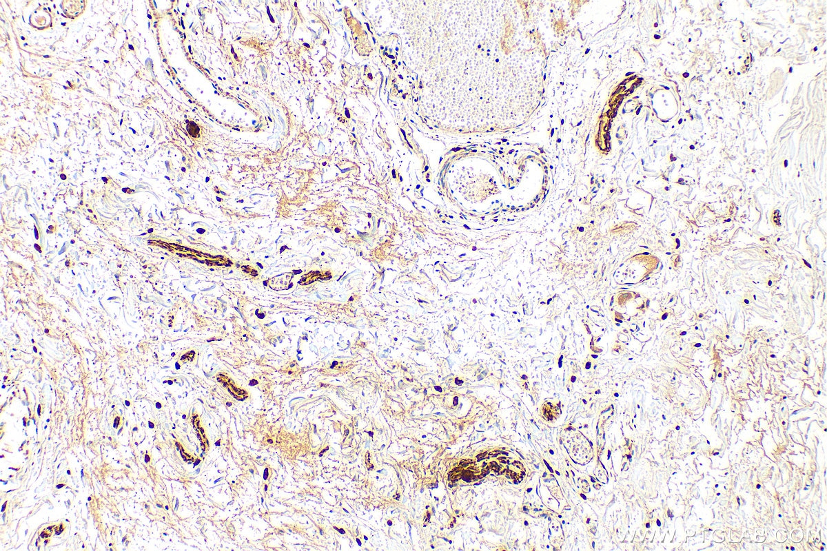 Immunohistochemistry (IHC) staining of human small intestine tissue using VIP Polyclonal antibody (16233-1-AP)