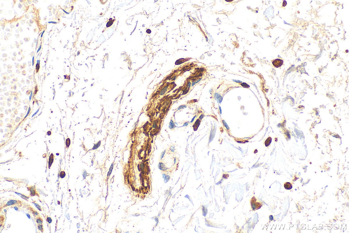 Immunohistochemistry (IHC) staining of human small intestine tissue using VIP Polyclonal antibody (16233-1-AP)