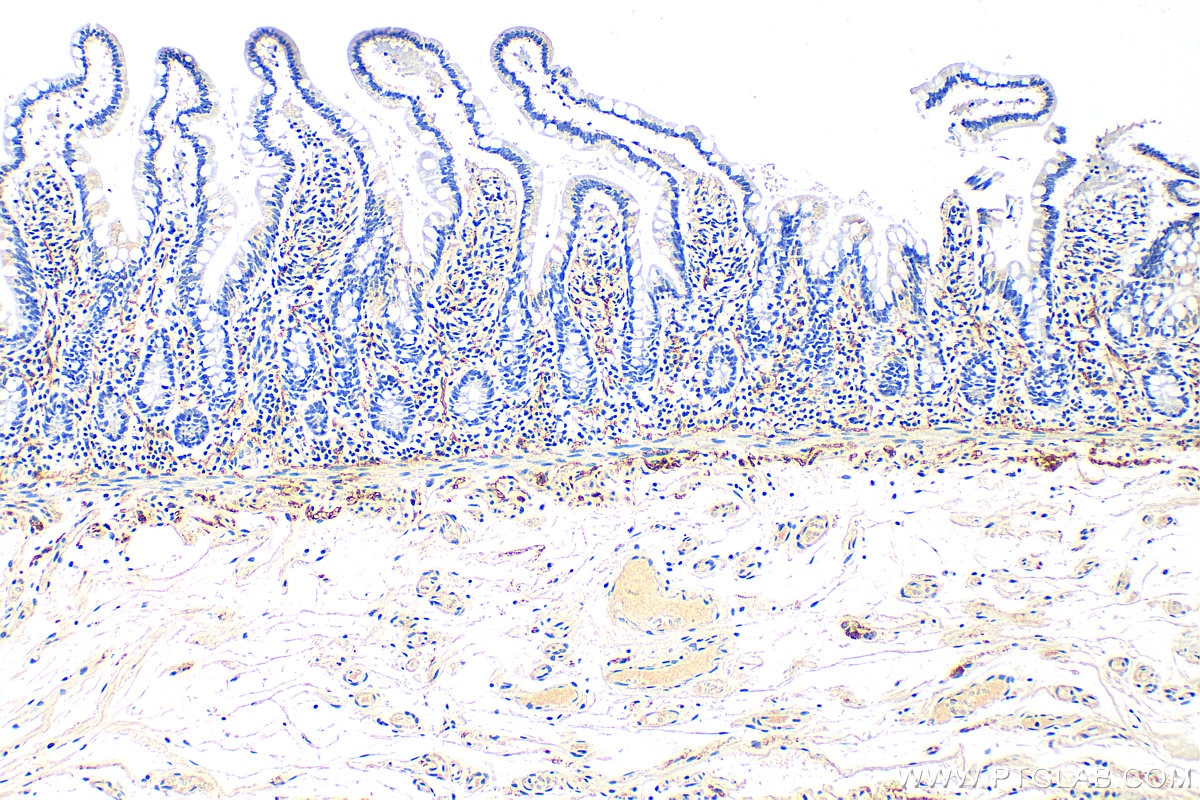 Immunohistochemistry (IHC) staining of human colon tissue using VIP Polyclonal antibody (16233-1-AP)