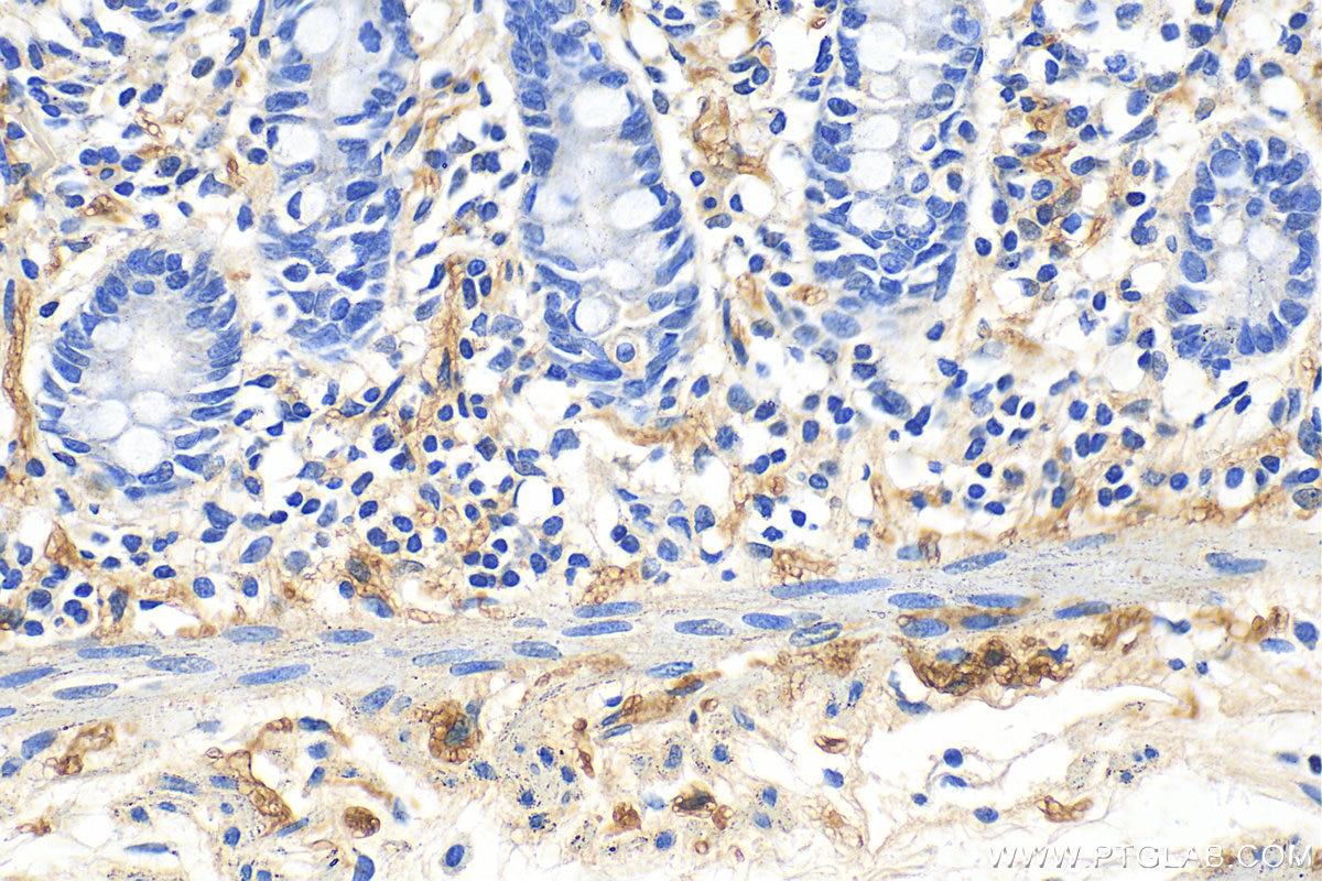 IHC staining of human colon using 16233-1-AP