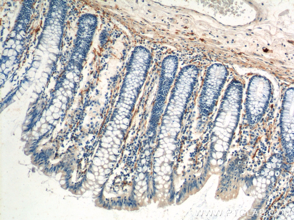 Immunohistochemistry (IHC) staining of human colon tissue using VIP Polyclonal antibody (16233-1-AP)