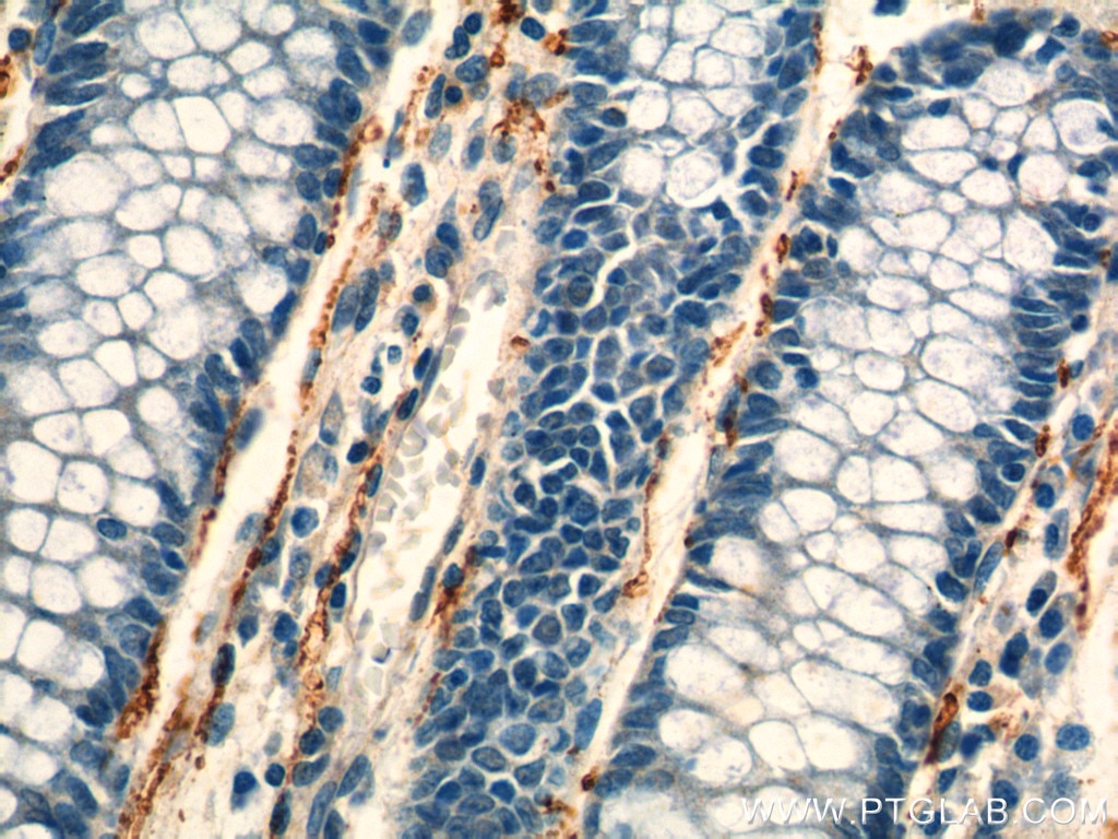 Immunohistochemistry (IHC) staining of human colon tissue using VIP Polyclonal antibody (16233-1-AP)