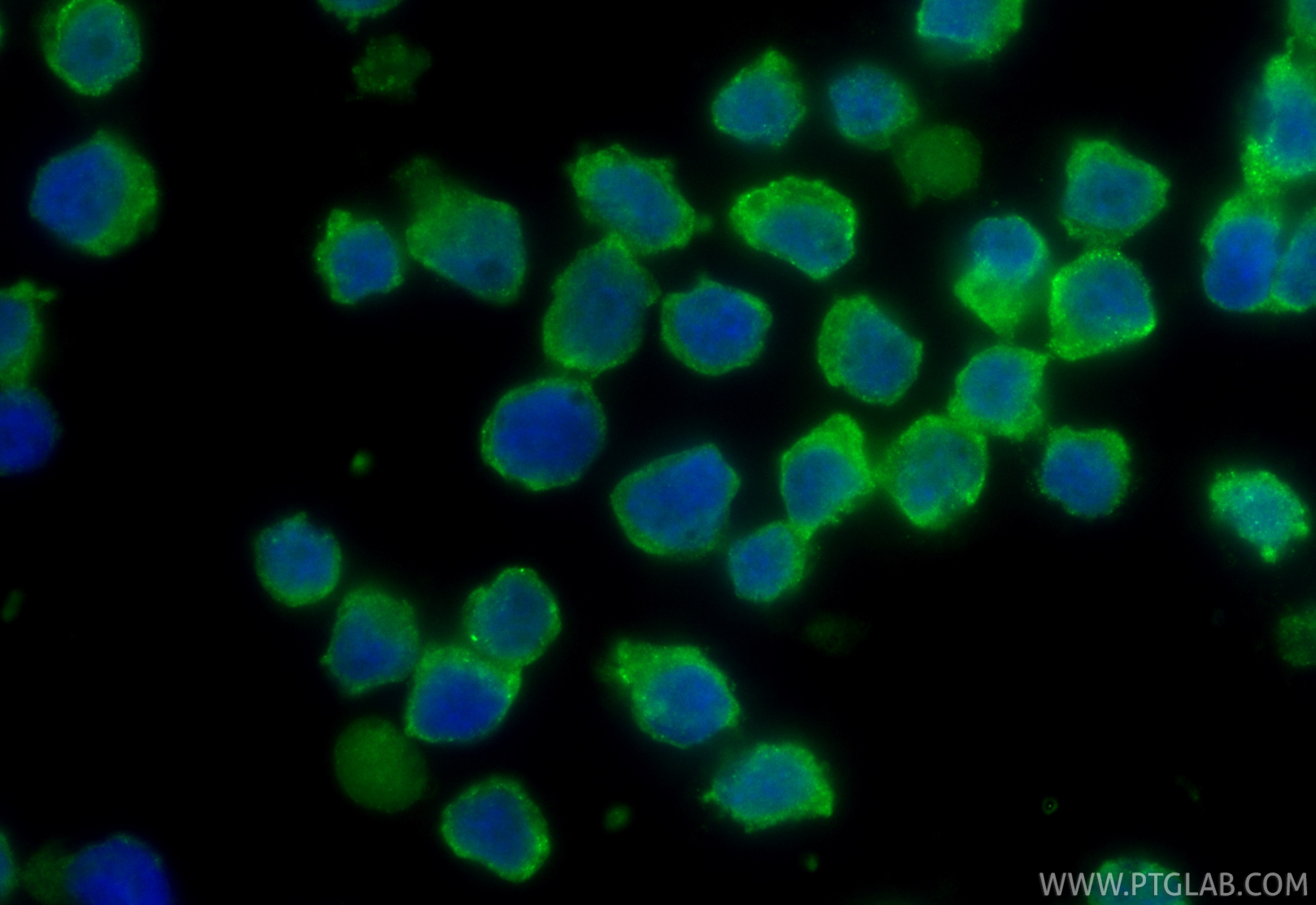 Immunofluorescence (IF) / fluorescent staining of COLO 320 cells using CoraLite® Plus 488-conjugated VIP Polyclonal antib (CL488-16233)