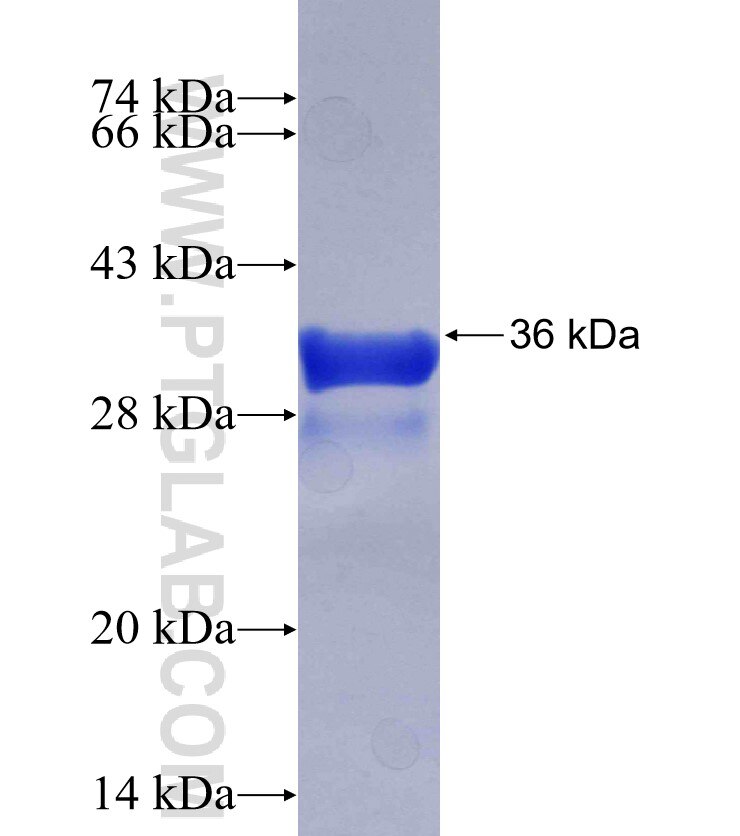 VIP fusion protein Ag29602 SDS-PAGE