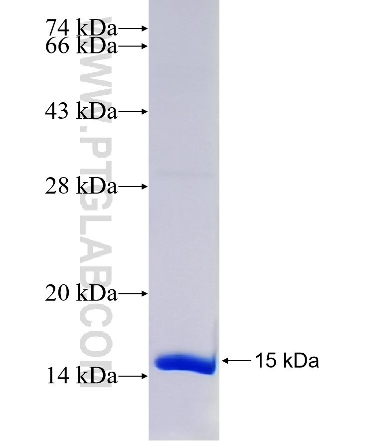 VIP fusion protein Ag29852 SDS-PAGE
