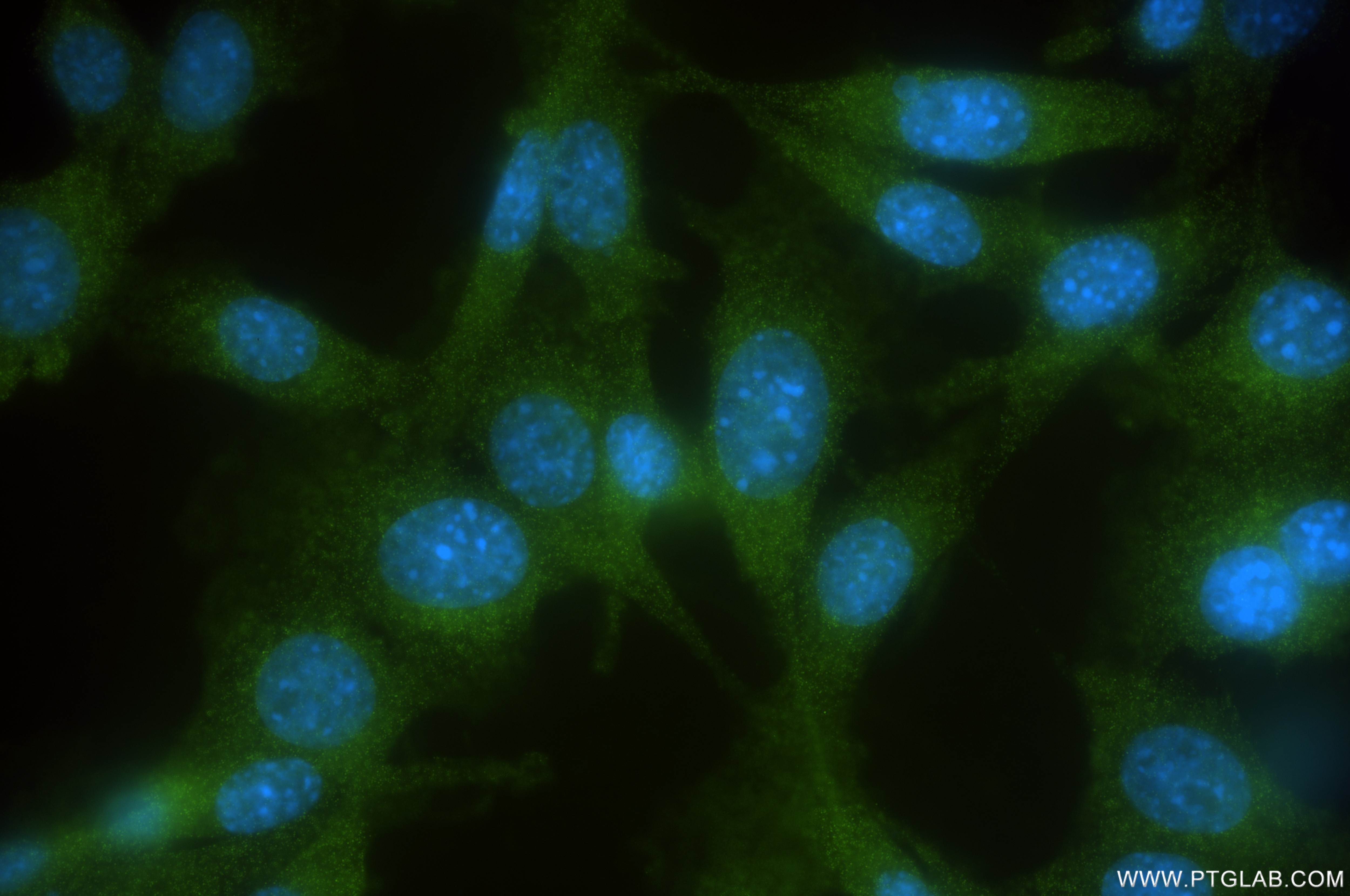 Immunofluorescence (IF) / fluorescent staining of NIH/3T3 cells using VIPAS39 Recombinant antibody (84320-2-RR)