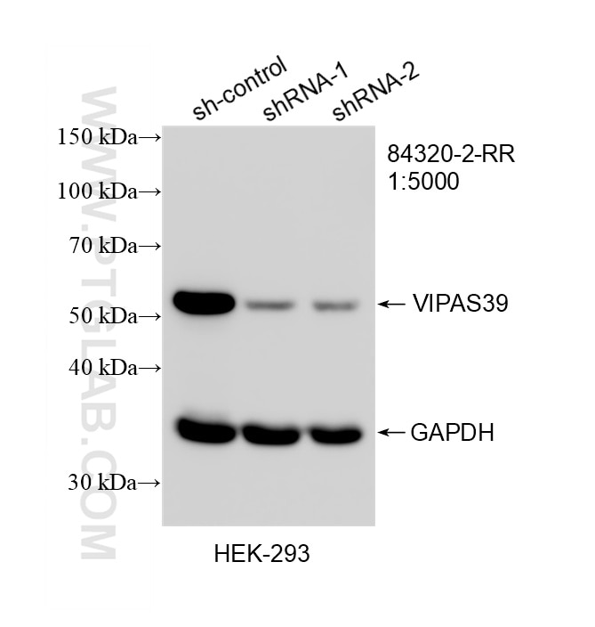 WB result of VIPAS39 antibody (84320-2-RR; 1:5000; incubated at room temperature for 1.5 hours) with sh-Control and sh-VIPAS39 transfected HEK-293 cells. This data was developed using the same antibody clone with 84320-2-PBS in a different storage buffer formulation. Western Blot (WB) analysis of HEK-293 cells using VIPAS39 Recombinant monoclonal antibody (84320-2-RR)