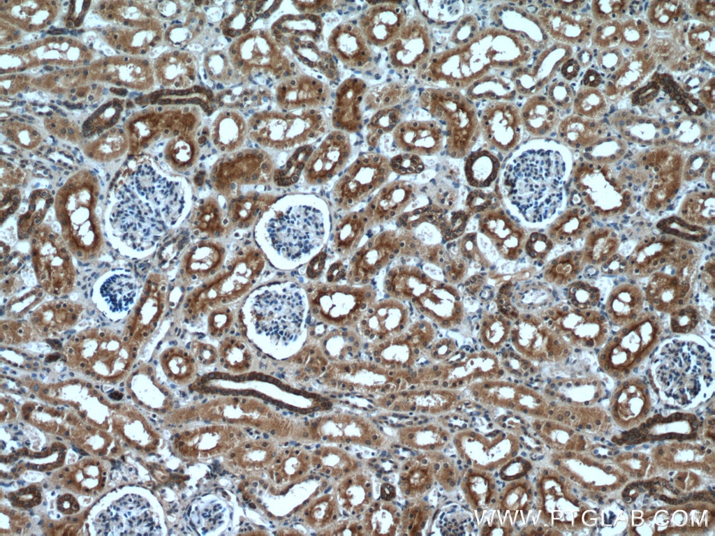 Immunohistochemistry (IHC) staining of human kidney tissue using VIPR1 Polyclonal antibody (14878-1-AP)