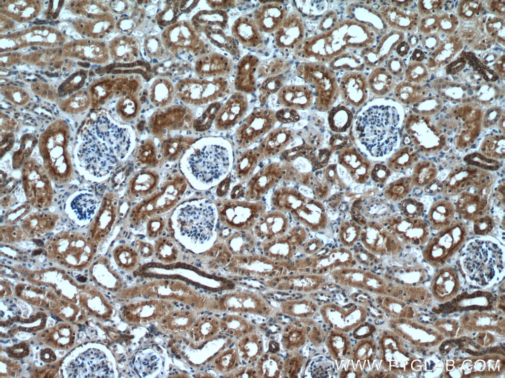 IHC staining of human kidney using 14878-1-AP