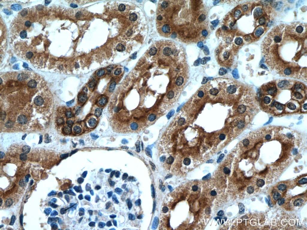 Immunohistochemistry (IHC) staining of human kidney tissue using VIPR1 Polyclonal antibody (14878-1-AP)