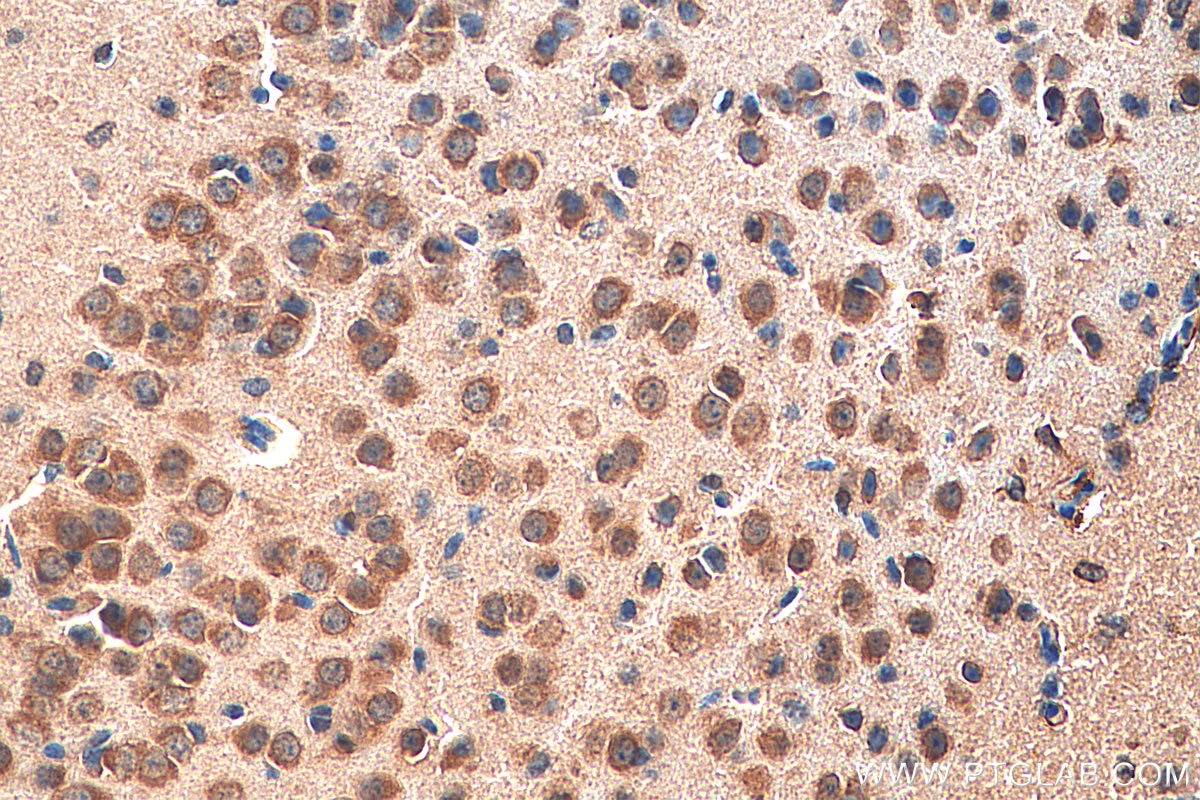 Immunohistochemistry (IHC) staining of mouse brain tissue using VIPR1 Polyclonal antibody (14878-1-AP)