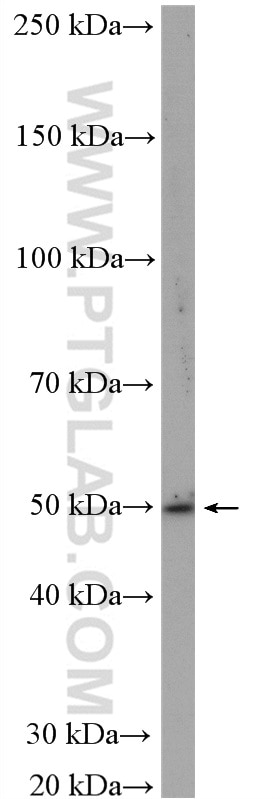 Western Blot (WB) analysis of mouse small intestine tissue using VIPR1 Polyclonal antibody (14878-1-AP)