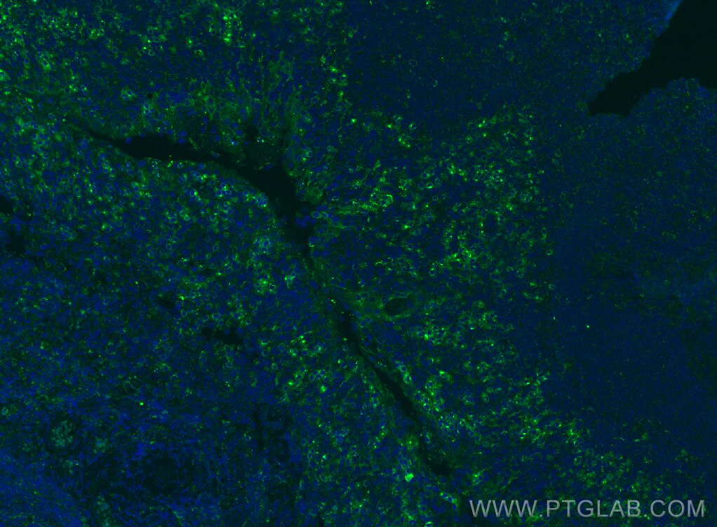 Immunofluorescence (IF) / fluorescent staining of human tonsillitis tissue using VISTA Polyclonal antibody (31619-1-AP)