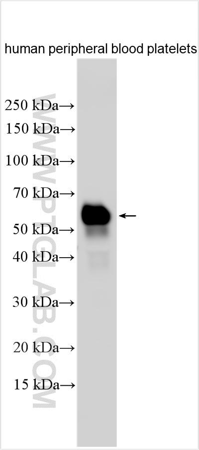 Western Blot (WB) analysis of various lysates using VISTA Polyclonal antibody (31619-1-AP)