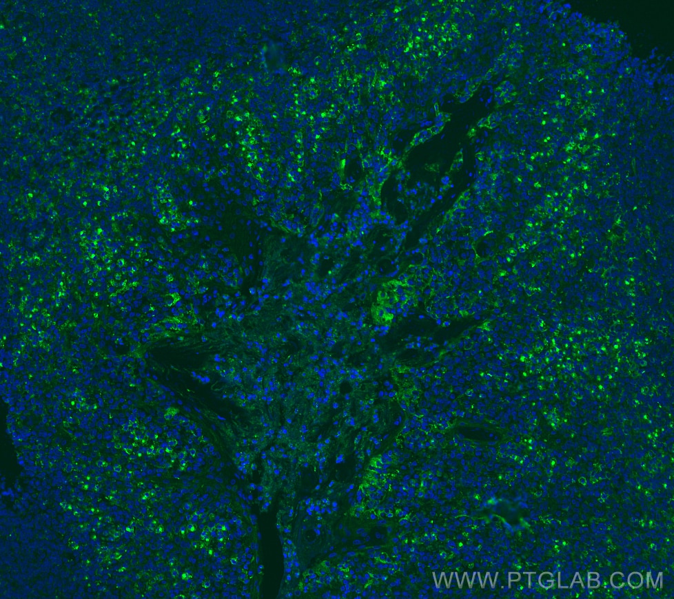 Immunofluorescence (IF) / fluorescent staining of human tonsillitis tissue using VISTA Recombinant antibody (83919-4-RR)