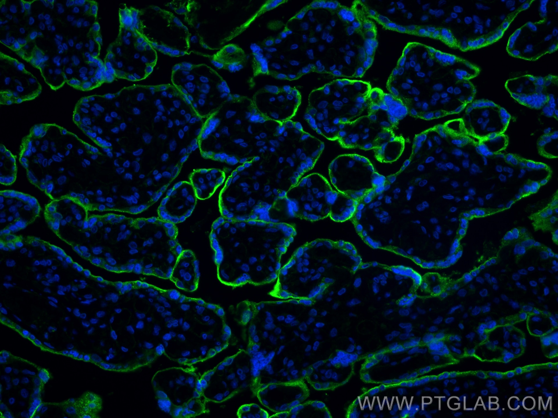 Immunofluorescence (IF) / fluorescent staining of human placenta tissue using VISTA Recombinant antibody (83919-4-RR)