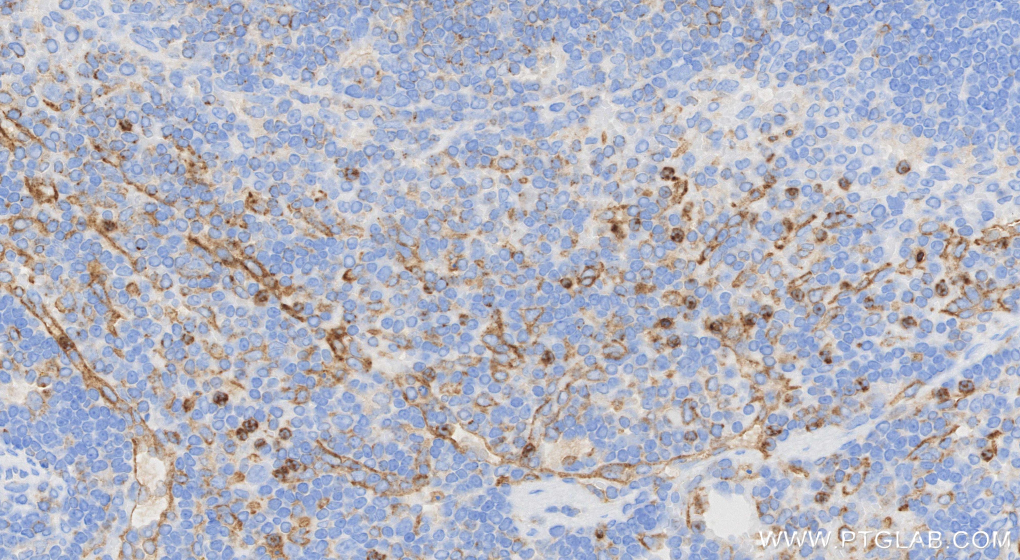Immunohistochemical analysis of paraffin-embedded mouse spleen tissue slide using 86114-3-RR (VISTA antibody) at dilution of 1:1000 (under 40x lens). Heat mediated antigen retrieval with Tris-EDTA buffer (pH 9.0). Immunohistochemistry (IHC) staining of mouse spleen tissue using VISTA Recombinant monoclonal antibody (86114-3-RR)