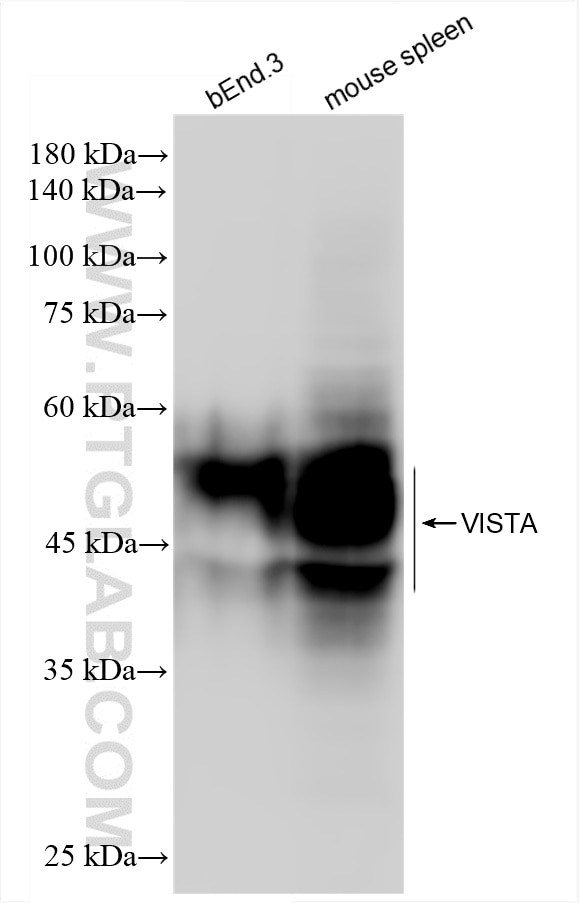 Western Blot (WB) analysis of various lysates using VISTA Recombinant antibody (86114-3-RR)