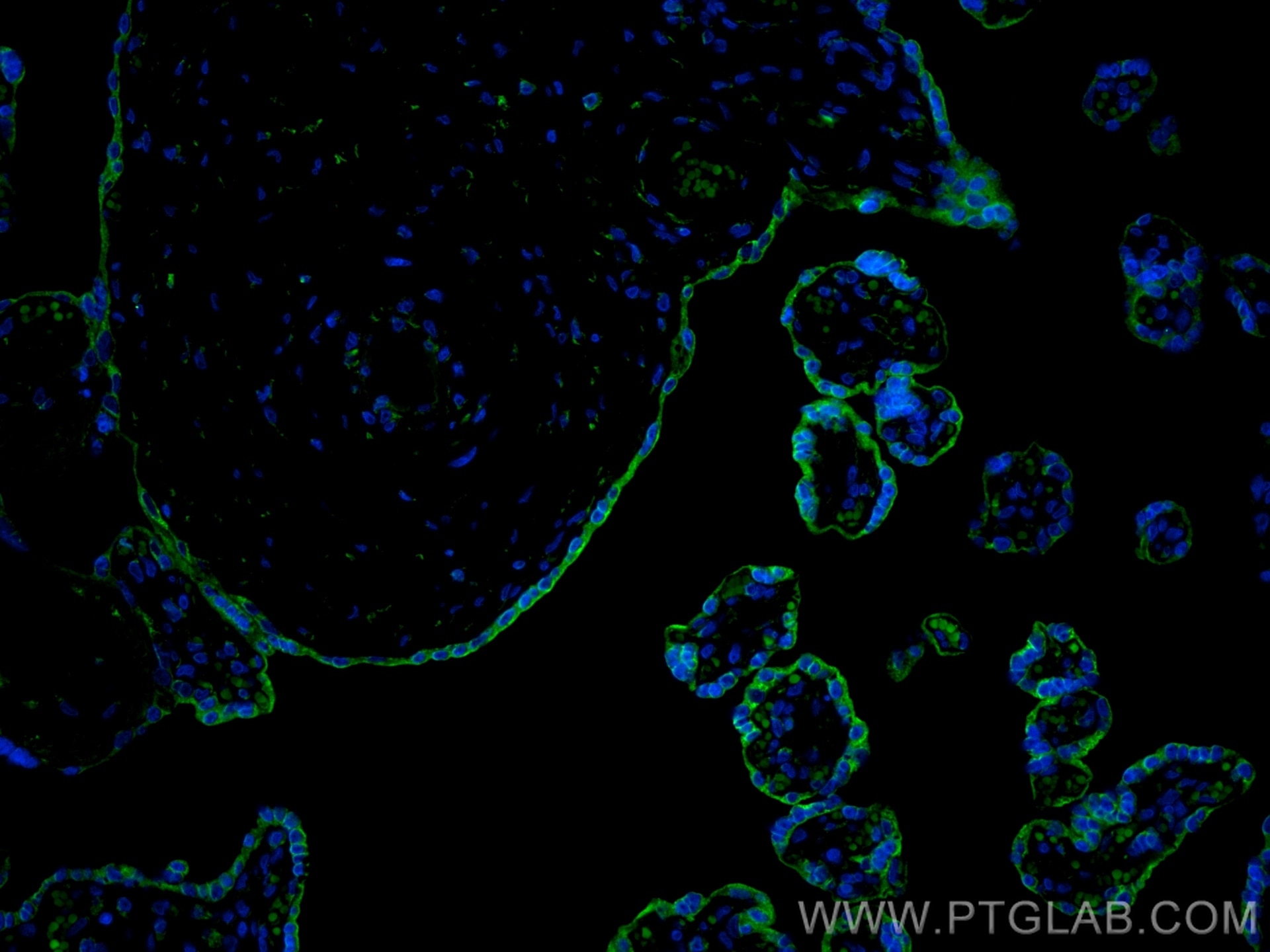 Immunofluorescence (IF) / fluorescent staining of human placenta tissue using CoraLite® Plus 488-conjugated VISTA Polyclonal ant (CL488-24849)