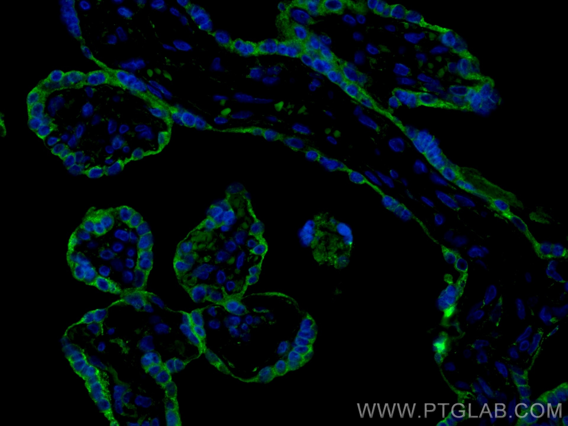 Immunofluorescence (IF) / fluorescent staining of human placenta tissue using CoraLite® Plus 488-conjugated VISTA Polyclonal ant (CL488-24849)