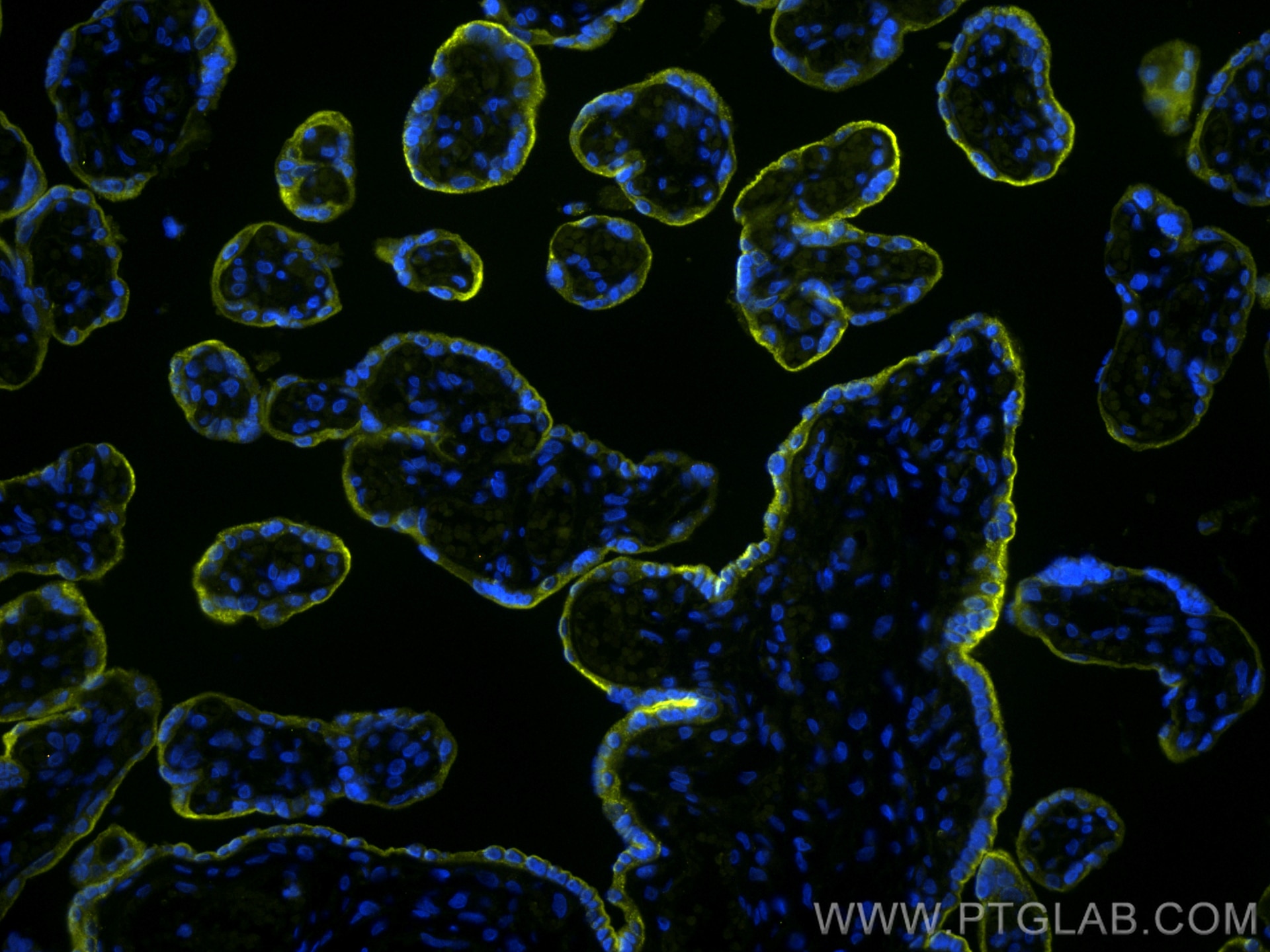 Immunofluorescence (IF) / fluorescent staining of human placenta tissue using CoraLite®532-conjugated VISTA Recombinant antibody (CL532-83919-4)
