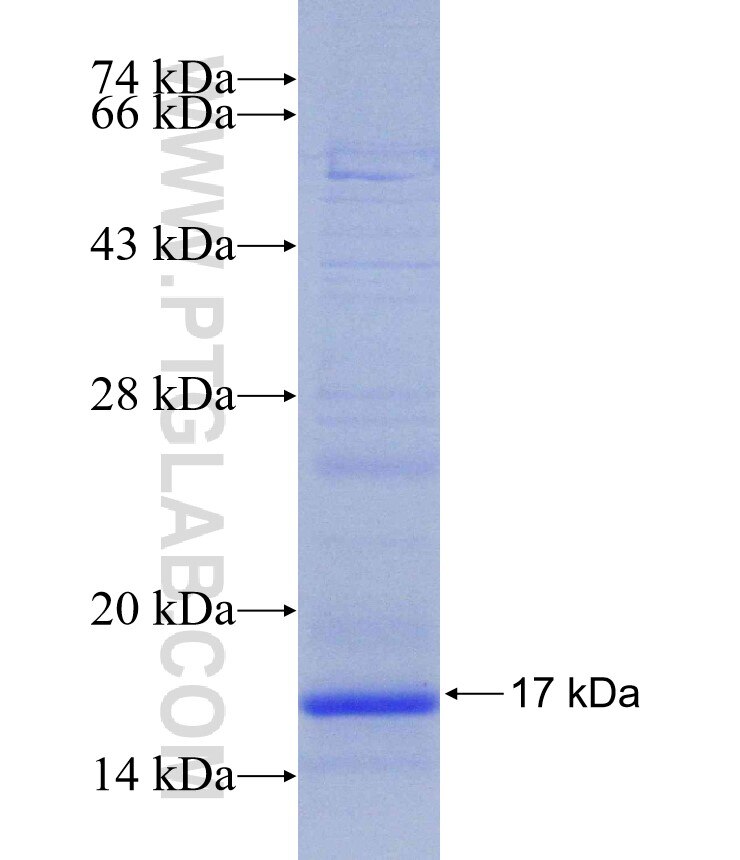 VKORC1 fusion protein Ag31328 SDS-PAGE