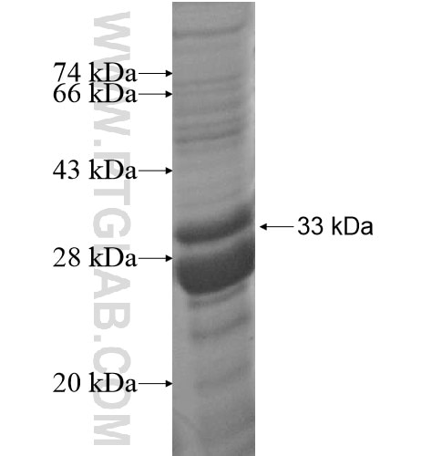 VKORC1 fusion protein Ag14060 SDS-PAGE