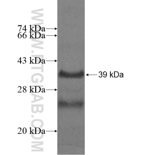 VKORC1L1 fusion protein Ag10296 SDS-PAGE