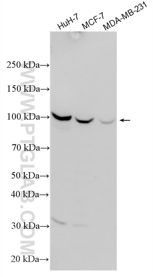 Various lysates were subjected to SDS PAGE followed by western blot with 19493-1-AP (VLDLR antibody) at dilution of 1:4000 incubated at room temperature for 1.5 hours. Western Blot (WB) analysis of various lysates using VLDLR Polyclonal antibody (19493-1-AP)