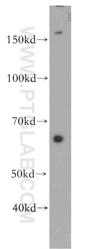Western Blot (WB) analysis of mouse ovary tissue using VLDLR Polyclonal antibody (19493-1-AP)