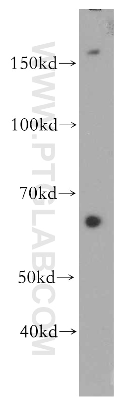 WB analysis of mouse ovary using 19493-1-AP