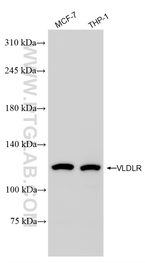 Western Blot (WB) analysis of various lysates using VLDLR Recombinant antibody (85097-1-RR)
