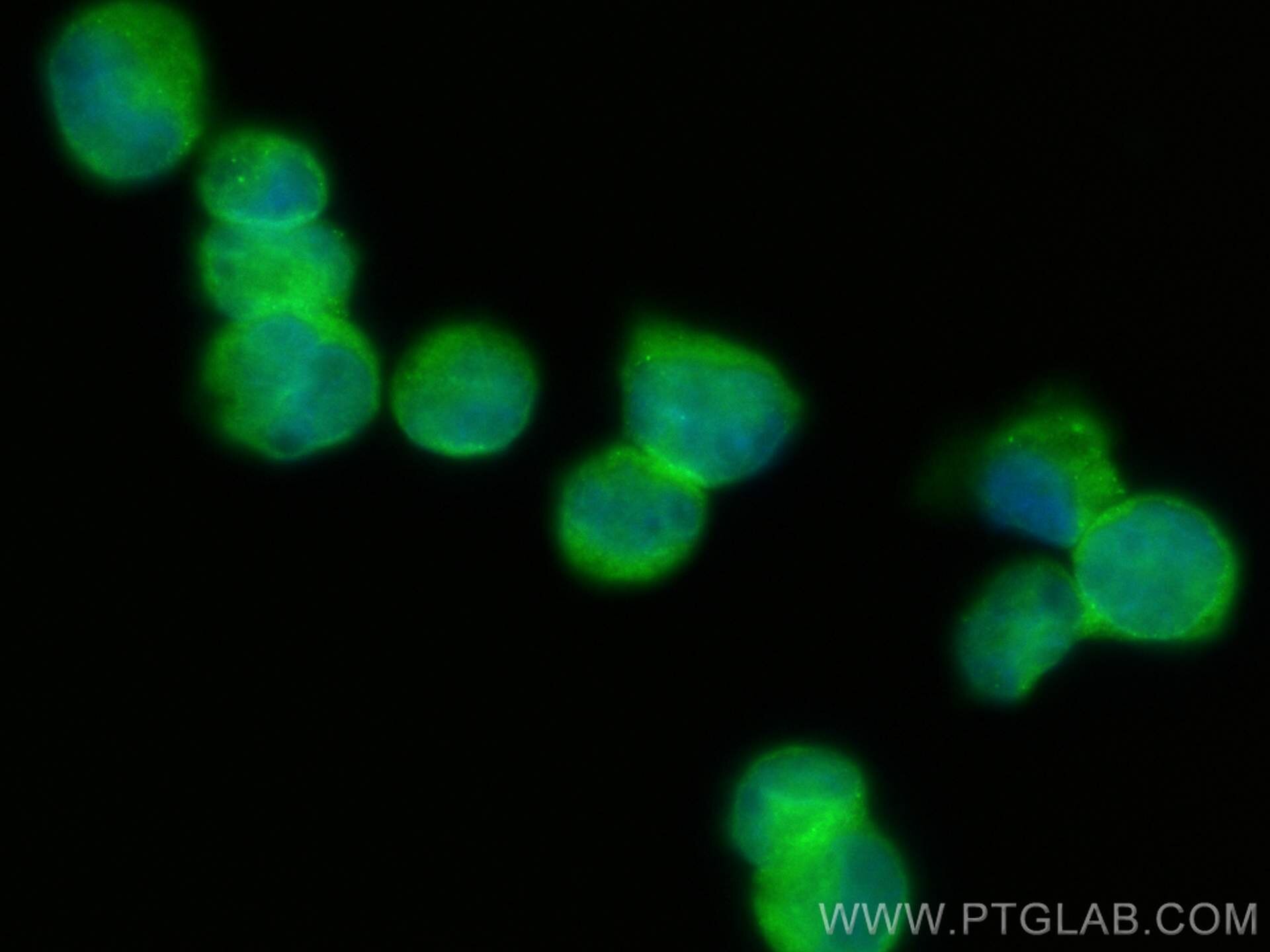 Immunofluorescence (IF) / fluorescent staining of K-562 cells using VLGR1 Polyclonal antibody (31628-1-AP)