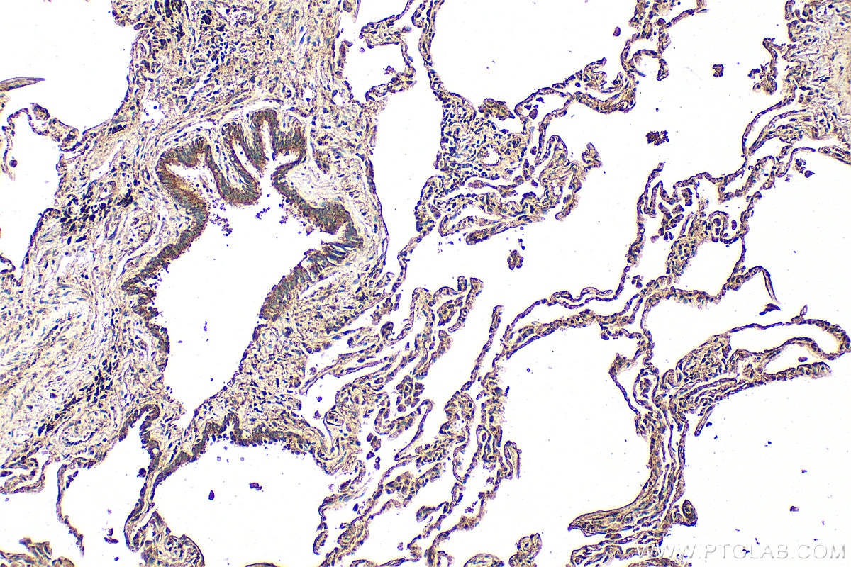 Immunohistochemistry (IHC) staining of human lung tissue using VLGR1 Polyclonal antibody (31628-1-AP)