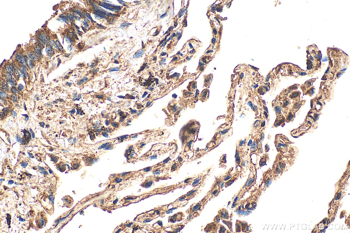 Immunohistochemistry (IHC) staining of human lung tissue using VLGR1 Polyclonal antibody (31628-1-AP)