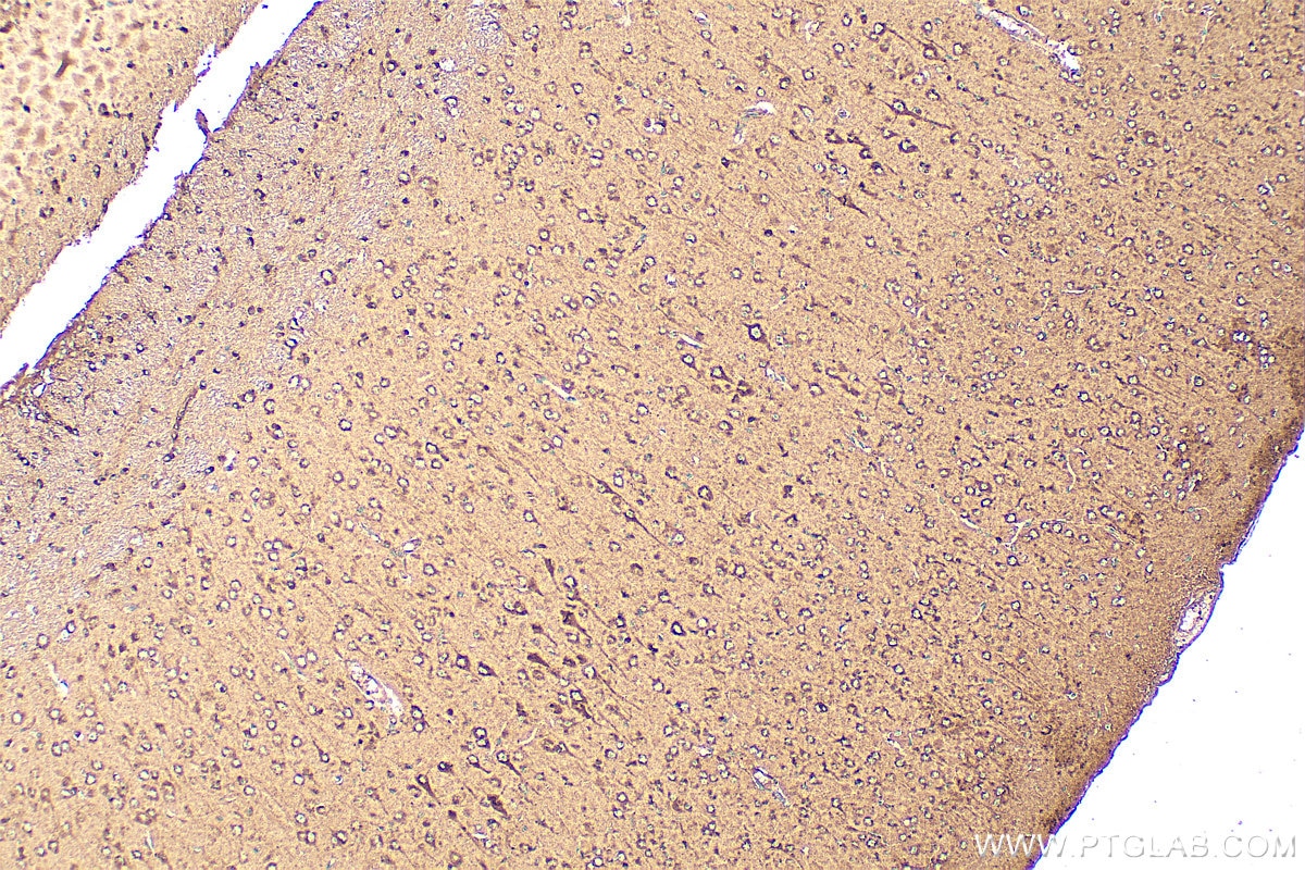 Immunohistochemistry (IHC) staining of mouse brain tissue using VLGR1 Polyclonal antibody (31628-1-AP)