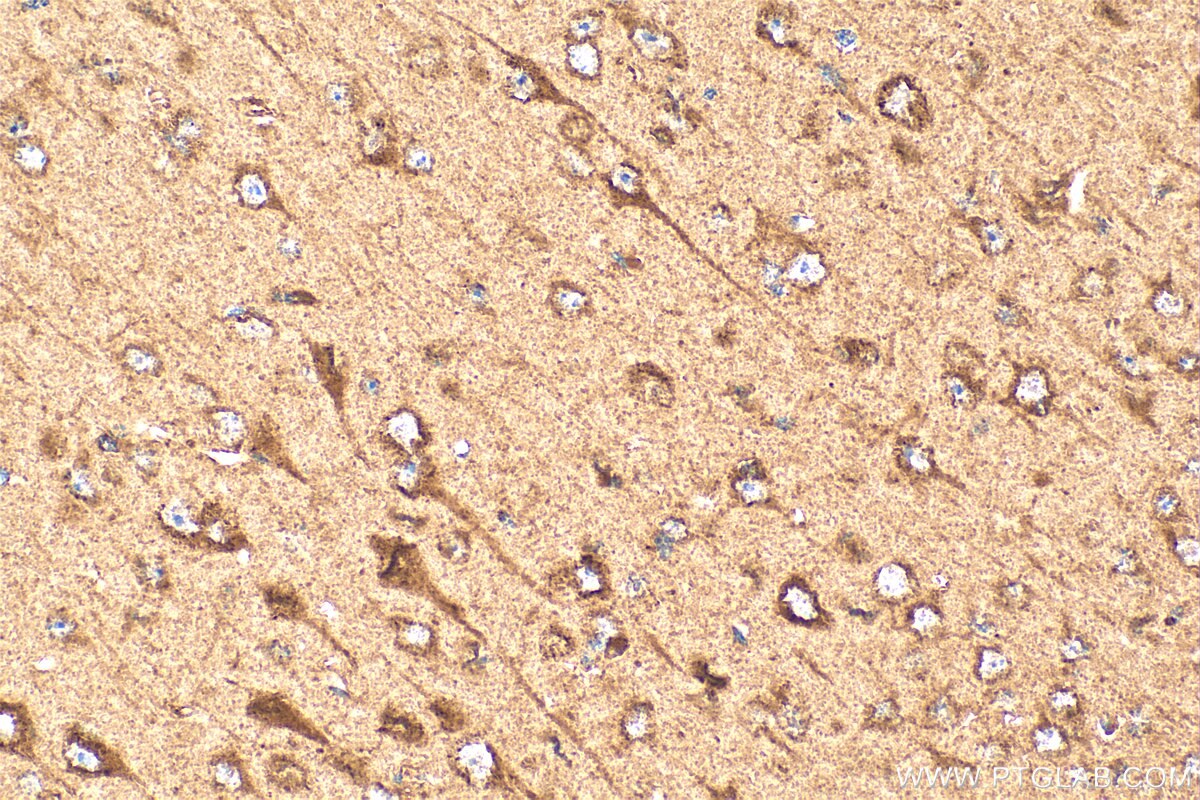 Immunohistochemistry (IHC) staining of mouse brain tissue using VLGR1 Polyclonal antibody (31628-1-AP)