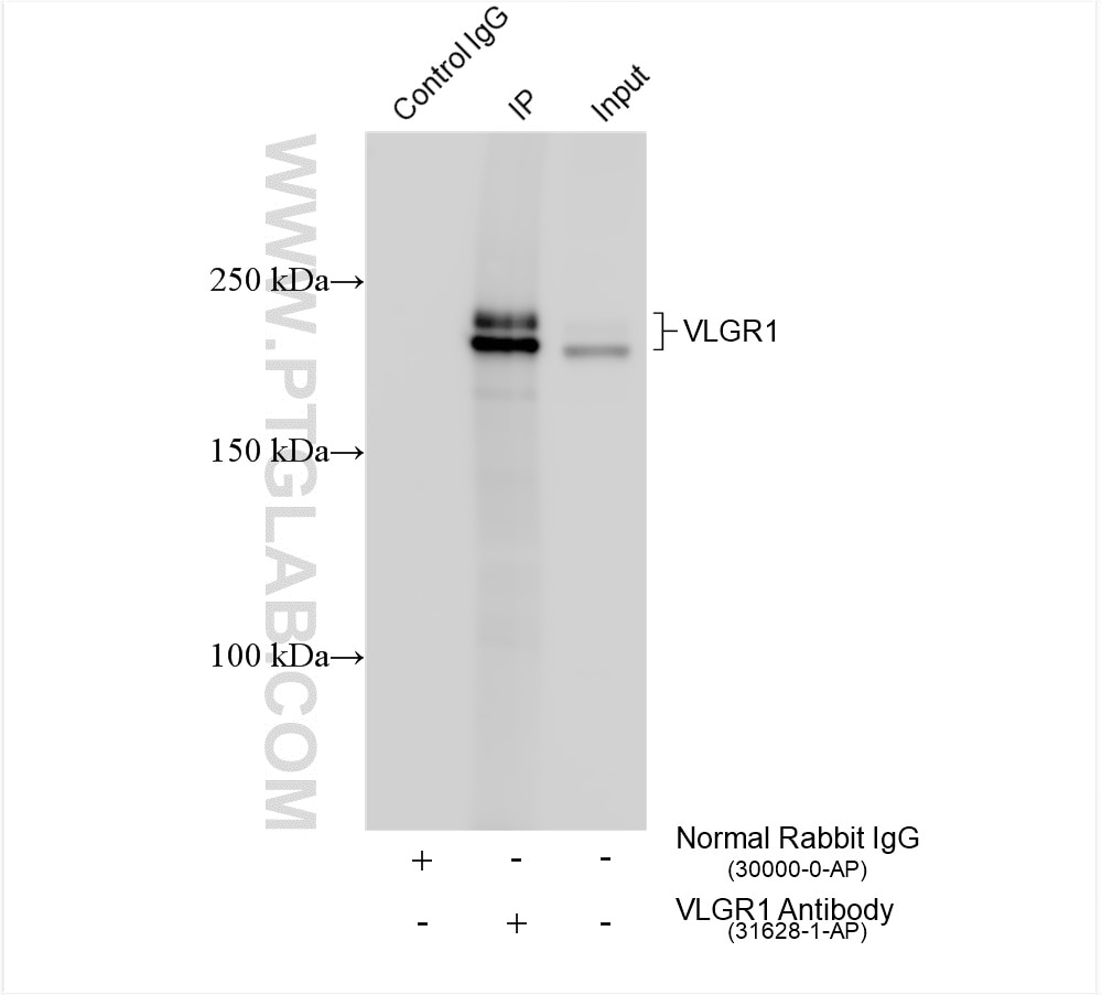 Immunoprecipitation (IP) experiment of SH-SY5Y cells using VLGR1 Polyclonal antibody (31628-1-AP)