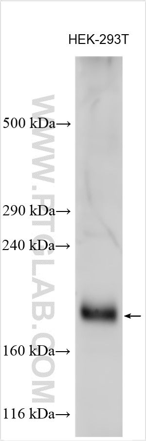 Western Blot (WB) analysis of various lysates using VLGR1 Polyclonal antibody (31628-1-AP)