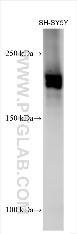 Western Blot (WB) analysis of various lysates using VLGR1 Polyclonal antibody (31628-1-AP)