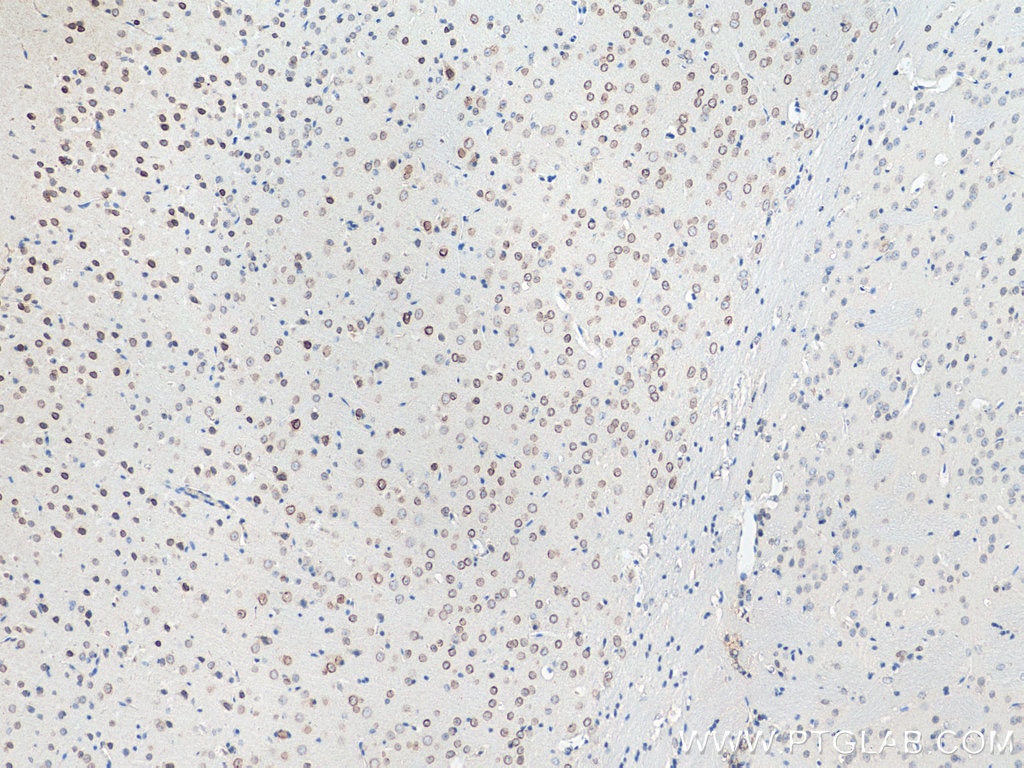 Immunohistochemistry (IHC) staining of mouse brain tissue using VMA21 Polyclonal antibody (21921-1-AP)