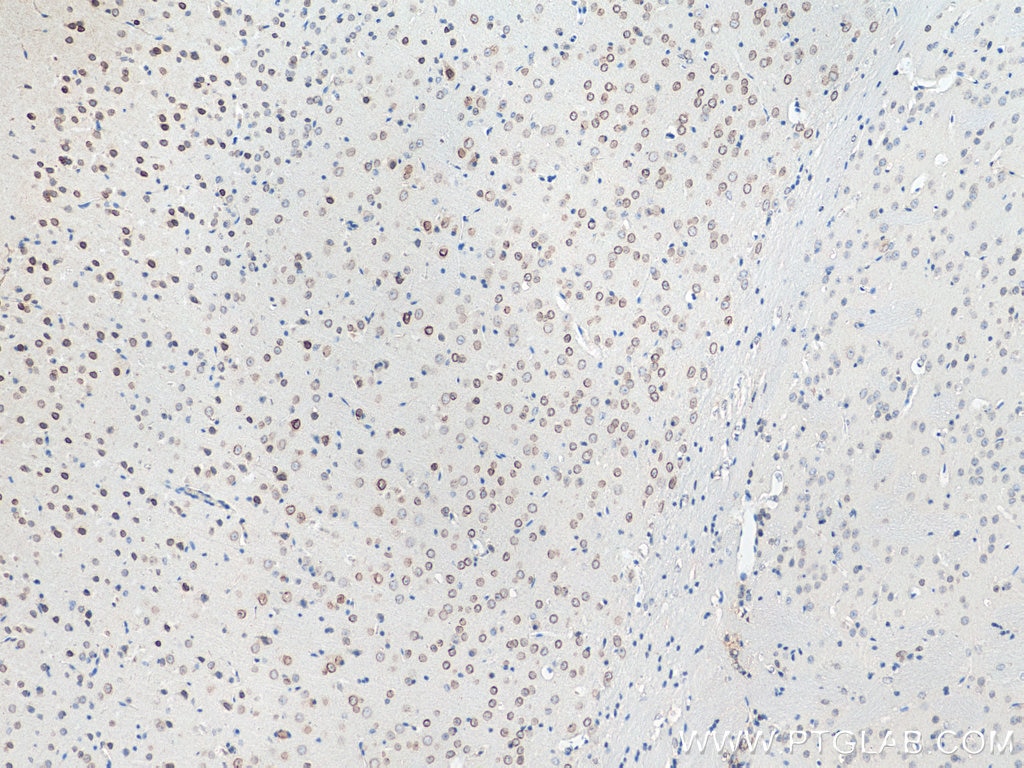 IHC staining of mouse brain using 21921-1-AP