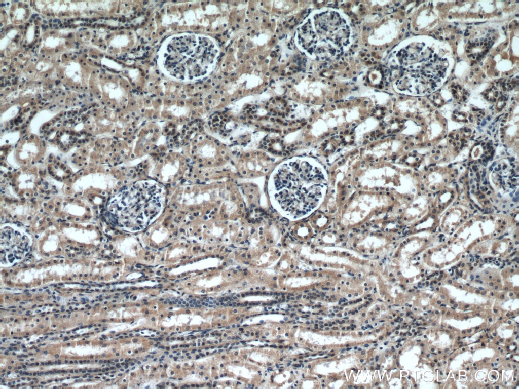 IHC staining of human kidney using 21921-1-AP