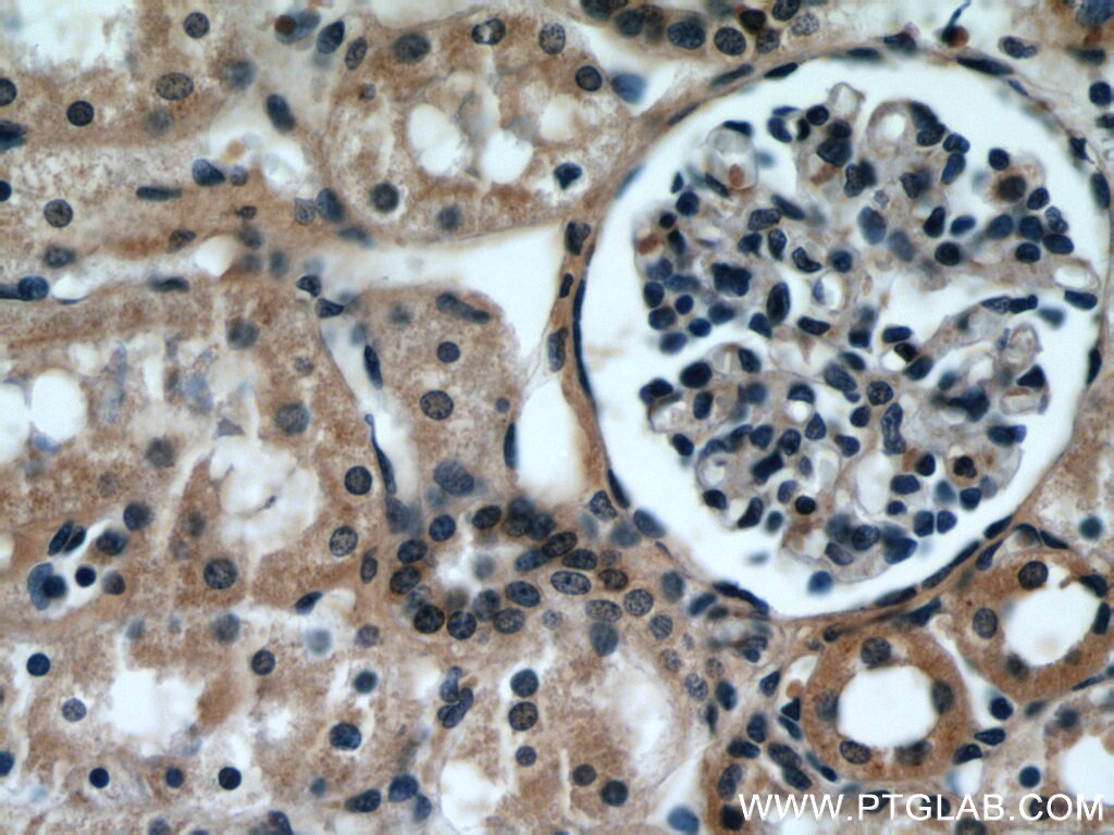 Immunohistochemistry (IHC) staining of human kidney tissue using VMA21 Polyclonal antibody (21921-1-AP)